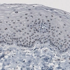 Immunohistochemical staining of human cervix shows strong nucleolar immunoreactivity in the epithelial cells.