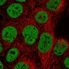 Immunofluorescent staining of human cell line CACO-2 shows localization to nucleoplasm.