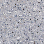 Anti-NOP56 Antibody