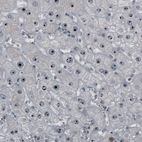 Immunohistochemical staining of human liver shows strong nucleolar positivity in hepatocytes.