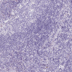 Immunohistochemical staining of human tonsil shows no cytoplasmic positivity in non-germinal center cells as expected.