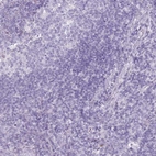 Immunohistochemical staining of human tonsil shows no cytoplasmic positivity in non-germinal center cells as expected.
