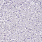 Immunohistochemical staining of human liver shows no cytoplasmic positivity in hepatocytes as expected.