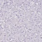 Immunohistochemical staining of human liver shows no cytoplasmic positivity in hepatocytes as expected.