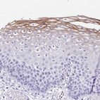 Immunohistochemical staining of human esophagus shows strong membranous positivity in squamous epithelial cells.