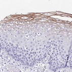 Immunohistochemical staining of human esophagus shows strong membranous positivity in squamous epithelial cells.