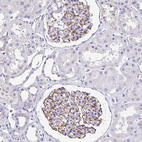 Immunohistochemical staining of human kidney shows strong membranous positivity in cells in glomeruli.