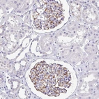 Immunohistochemical staining of human kidney shows strong membranous positivity in cells in glomeruli.