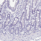 Immunohistochemical staining of human duodenum shows no membranous positivity in glandular cells as expected.