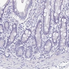 Immunohistochemical staining of human duodenum shows no membranous positivity in glandular cells as expected.