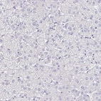 Immunohistochemical staining of human liver shows no membranous positivity in hepatocytes as expected.