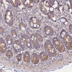 Immunohistochemical staining of human duodenum shows moderate cytoplasmic positivity in glandular cells.
