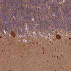 Immunohistochemical staining of human cerebellum shows strong cytoplasmic positivity in Purkinje cells.