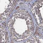 Immunohistochemical staining of human testis shows moderate cytoplasmic positivity in cells in seminiferous ducts and leydig cells.