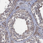 Immunohistochemical staining of human testis shows moderate cytoplasmic positivity in cells in seminiferous ducts and leydig cells.