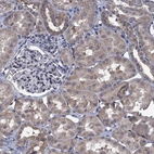 Immunohistochemical staining of human kidney shows moderate cytoplasmic positivity in cells in tubules.