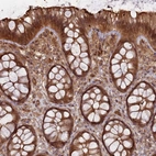 Immunohistochemical staining of human colon shows strong cytoplasmic positivity in glandular cells.