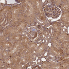 Immunohistochemical staining of human kidney shows strong cytoplasmic positivity in cells in tubules.