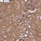 Immunohistochemical staining of human kidney shows strong cytoplasmic positivity in cells in tubules.