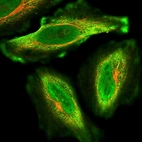 Immunofluorescent staining of human cell line HeLa shows localization to nucleoplasm & plasma membrane.