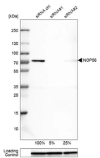 Western blot analysis in U-251MG cells transfected with control siRNA, target specific siRNA probe #1 and #2, using Anti-NOP56 antibody. Remaining relative intensity is presented. Loading control: Anti-GAPDH.