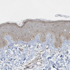 Immunohistochemical staining of human skin shows moderate cytoplasmic/ nuclear positivity in squamous epithelial cells.