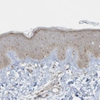 Immunohistochemical staining of human skin shows moderate cytoplasmic/ nuclear positivity in squamous epithelial cells.