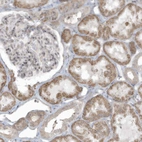 Immunohistochemical staining of human kidney shows strong cytoplasmic positivity in cells in tubules.