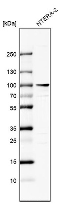 Western blot analysis in human cell line NTERA-2.