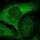 Immunofluorescent staining of human cell line U-2 OS shows localization to cytosol.