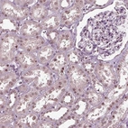 Immunohistochemical staining of human kidney shows moderate nuclear positivity in glandular cells.