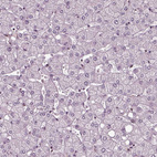 Immunohistochemical staining of human liver shows no positivity in hepatocytes as expected.