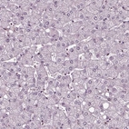 Immunohistochemical staining of human liver shows no positivity in hepatocytes as expected.