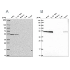 Western blot analysis using Anti-RUVBL2 antibody HPA067966 (A) shows similar pattern to independent antibody HPA042880 (B).