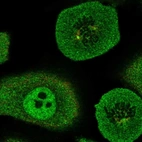 Immunofluorescent staining of human cell line A549 shows localization to nucleoplasm, cytosol & centrosome.
