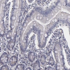 Immunohistochemical staining of human small intestine shows no cytoplasmic positivity in glandular cells as expected.
