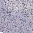 Immunohistochemical staining of human pancreas shows no cytoplasmic positivity in exocrine glandular cells as expected.