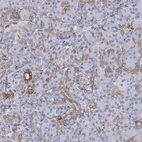 Immunohistochemical staining of human pancreas shows strong membranous positivity in exocrine glandular cells.