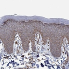 Immunohistochemical staining of human skin shows strong cytoplasmic and membranous positivity in squamous epithelial cells.