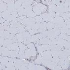 Immunohistochemical staining of human skeletal muscle shows no positivity in myocytes as expected.