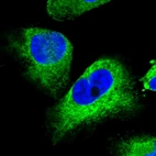 Immunofluorescent staining of human cell line U-251 MG shows localization to endoplasmic reticulum.