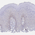Immunohistochemical staining of human skin shows negative to very weak cytoplasmic granular positivity in squamous epithelial cells as expected.