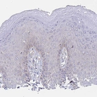 Immunohistochemical staining of human skin shows negative to very weak cytoplasmic granular positivity in squamous epithelial cells as expected.
