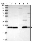 Lane 1: Marker [kDa] 250, 130, 95, 72, 55, 36, 28, 17, 10_br/_Lane 2: Human cell line RT-4_br/_Lane 3: Human cell line U-251 MG_br/_Lane 4: Human plasma_br/_Lane 5: Human Liver tissue_br/_Lane 6: Human Tonsil tissue