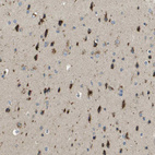 Immunohistochemical staining of human cerebral cortex shows strong cytoplasmic granular positivity in neurons.
