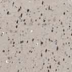 Immunohistochemical staining of human cerebral cortex shows strong cytoplasmic granular positivity in neurons.