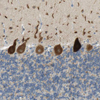 Immunohistochemical staining of human cerebellum shows strong cytoplasmic granular positivity in Purkinje cells.