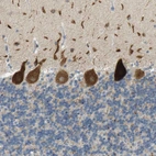 Immunohistochemical staining of human cerebellum shows strong cytoplasmic granular positivity in Purkinje cells.