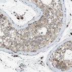 Immunohistochemical staining of human testis shows moderate cytoplasmic granular positivity in cells in seminiferous ducts.
