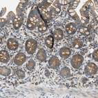 Immunohistochemical staining of human small intestine shows moderate cytoplasmic granular positivity in glandular cells.